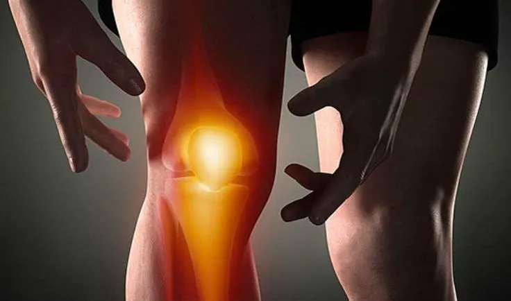 Özel Şifa Tıp - Dizde Kireçlenme Neden Olur Kireçlenmeye Ne İyi Gelir